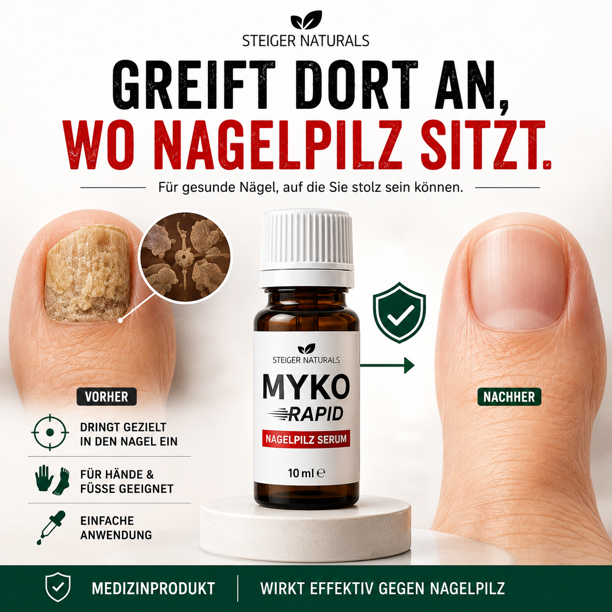 Myko Rapid Nagelpilz Serum