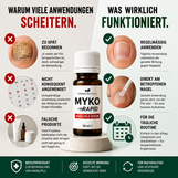 Myko Rapid Nagelpilz Serum